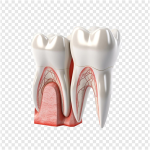 What are the Cavities, and how do we prevent them?